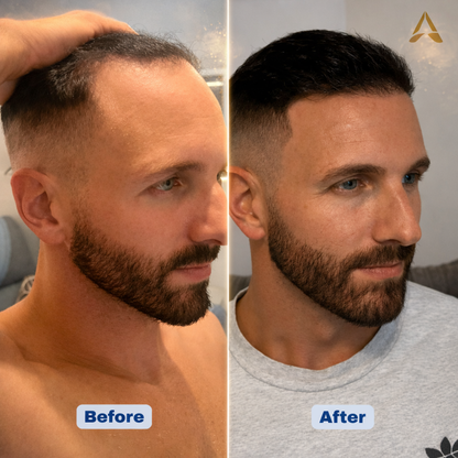 Aurevia Hair Growth Serum